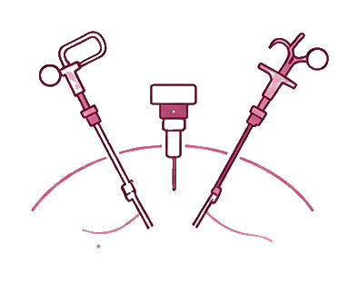 Cirugía mínima invasiva cuando es necesaria