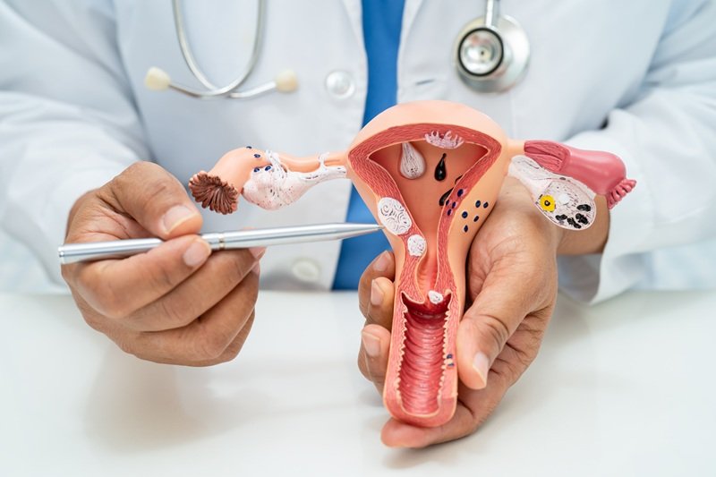 Tratamiento Integral de la Endometriosis